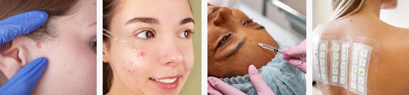 Dothan Dermatologists: Your Trusted Skin Care Experts in Dothan, Alabama